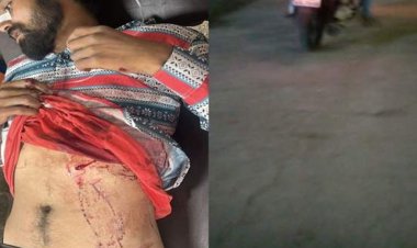 इंदौर में दो बदमाशों ने युवक को मारा चाकू:शराब खरीदने को लेकर हुआ था विवाद, पुलिस आरोपियों की तलाश में जुटी