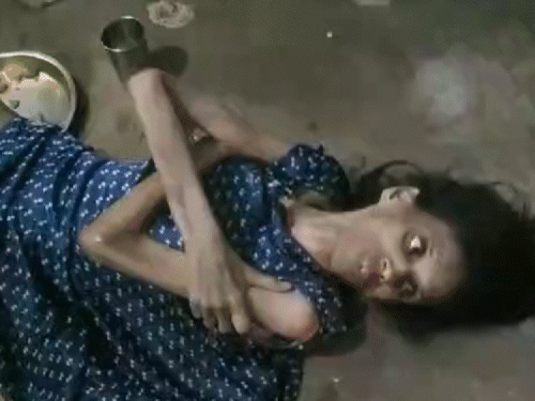 भोपाल में 16 साल से बंधक महिला की मौत:पुलिस ने 9 दिन पहले पिता की शिकायत पर ससुराल से किया था रेस्क्यू, रस्सी से बंधी मिली थी