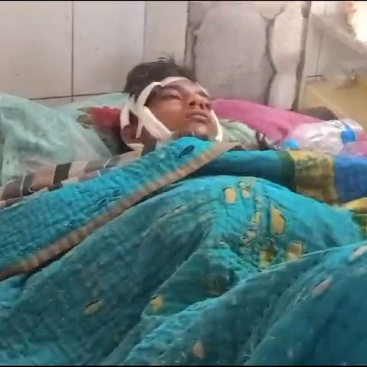 16 साल के छात्र को 5 लोगों ने पीटा:सिर में आए 7 टांके, खर्चे के लिए की गई मजदूरी के पैसे मांगने पर मिली सजा