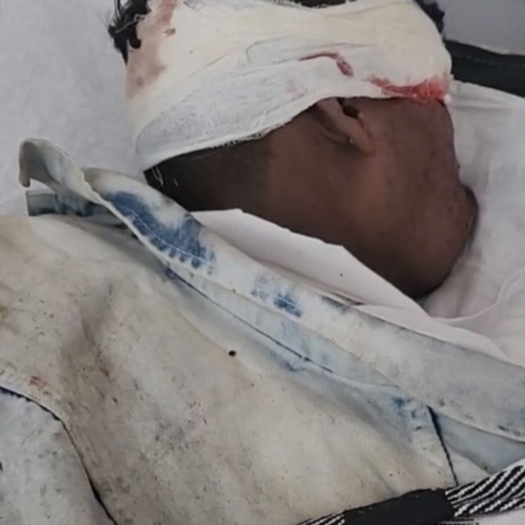 बैतूल-नागपुर हाईवे में गंभीर हालत में मिला युवक:अज्ञात वाहन की टक्कर से घायल होने की आशंका; पुलिस युवक की पहचान करने में जुटी