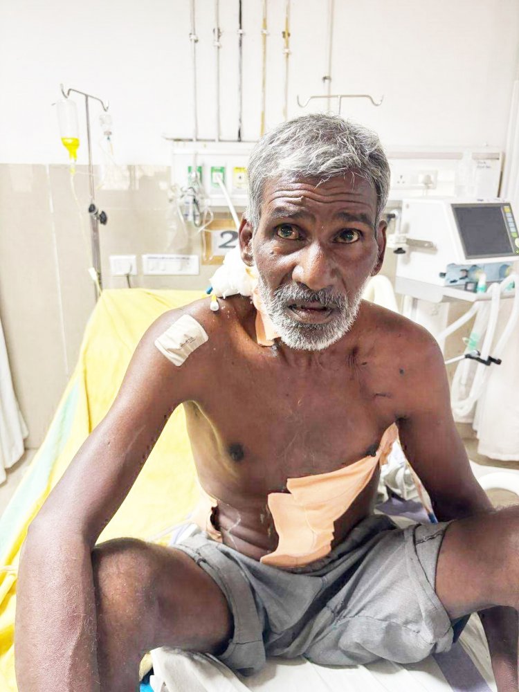 सडक़ दुर्घटना में घायल का मेडिकल कॉलेज रायगढ़ में ऑपरेशन